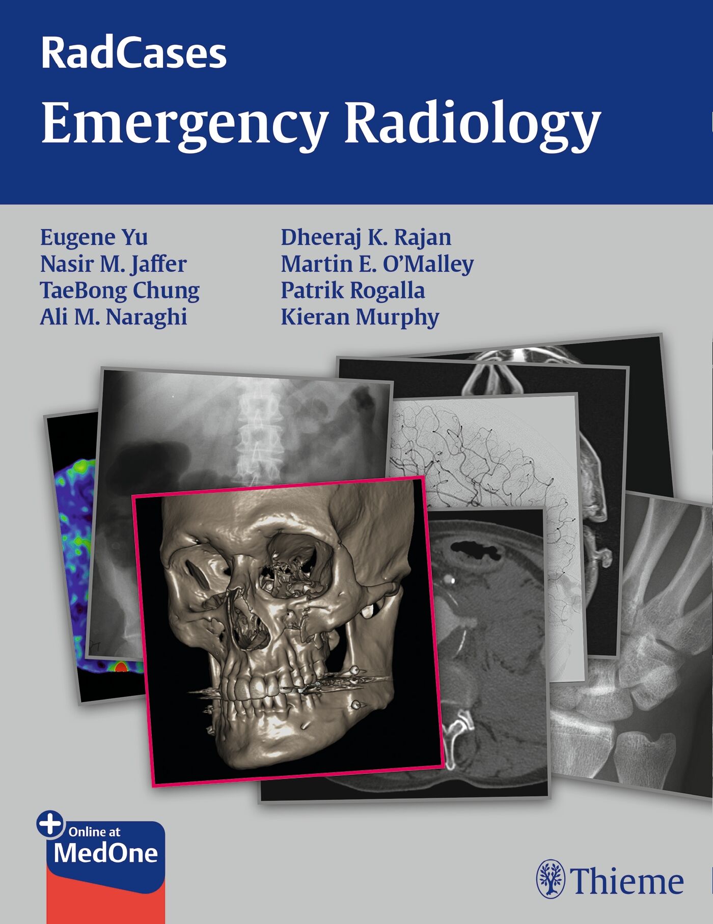 Radcases Emergency Radiology, 9781604068337