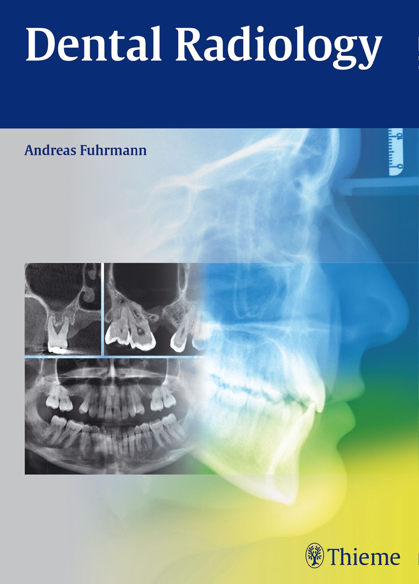 Dental Radiology, 9783132004214