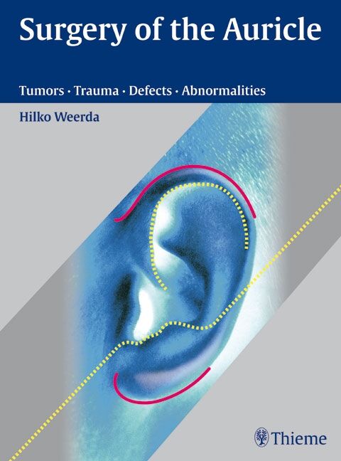 Surgery of the Auricle, 9783131394118
