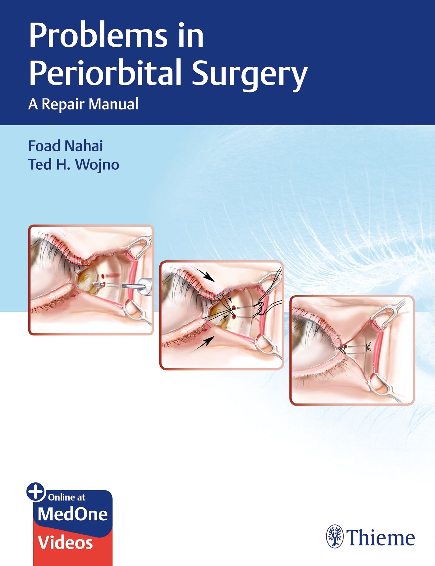 Problems in Periorbital Surgery, 9781626237087