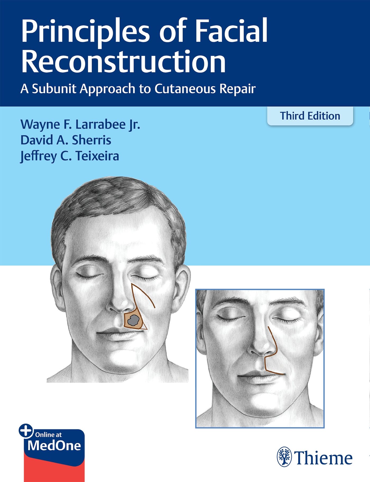 Principles of Facial Reconstruction, 9781684201068