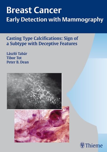 Casting-Type Calcifications: Sign of a Subtype with Deceptive Features, 9783131353917
