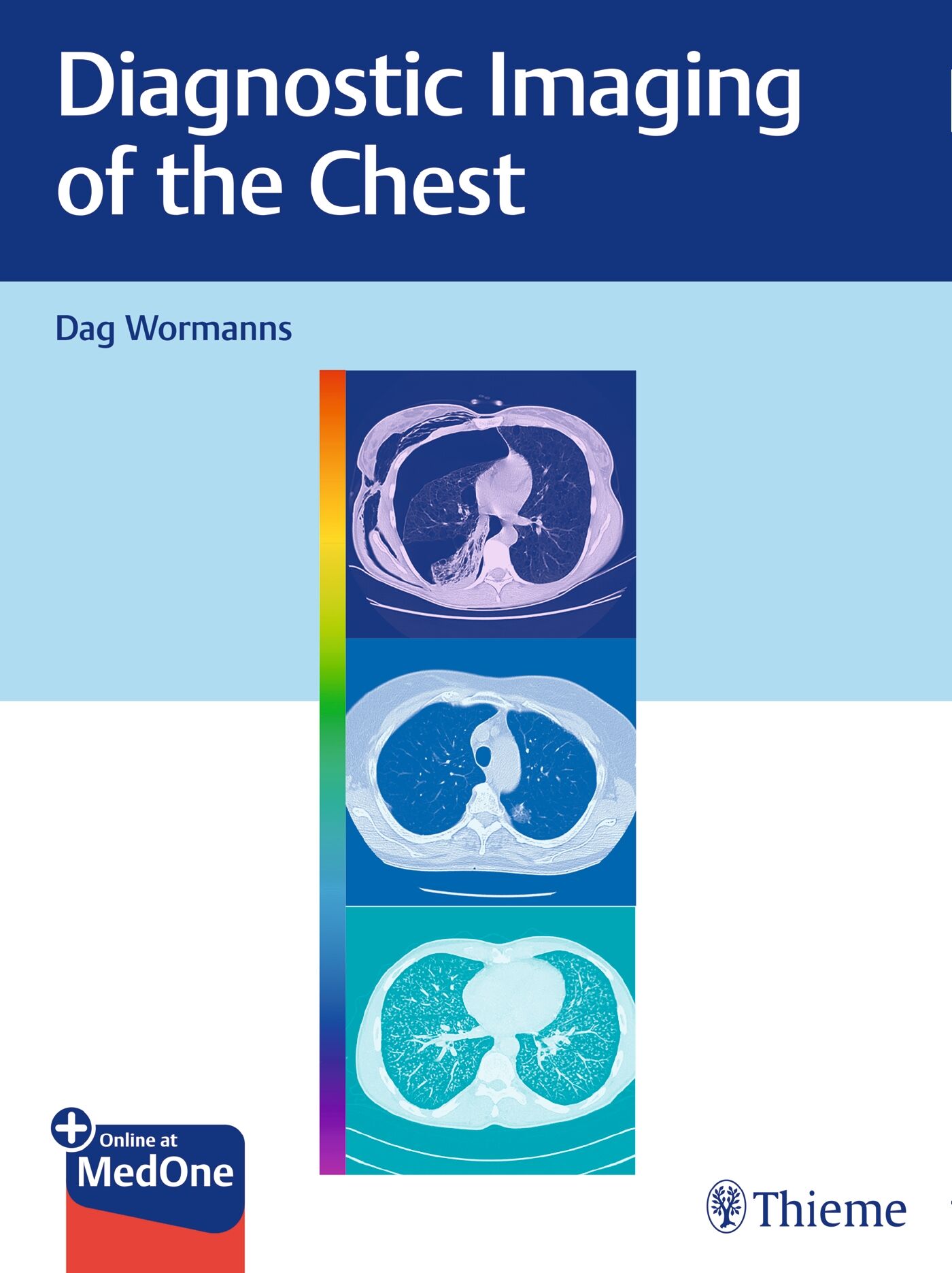 Diagnostic Imaging of the Chest, 9783132415669