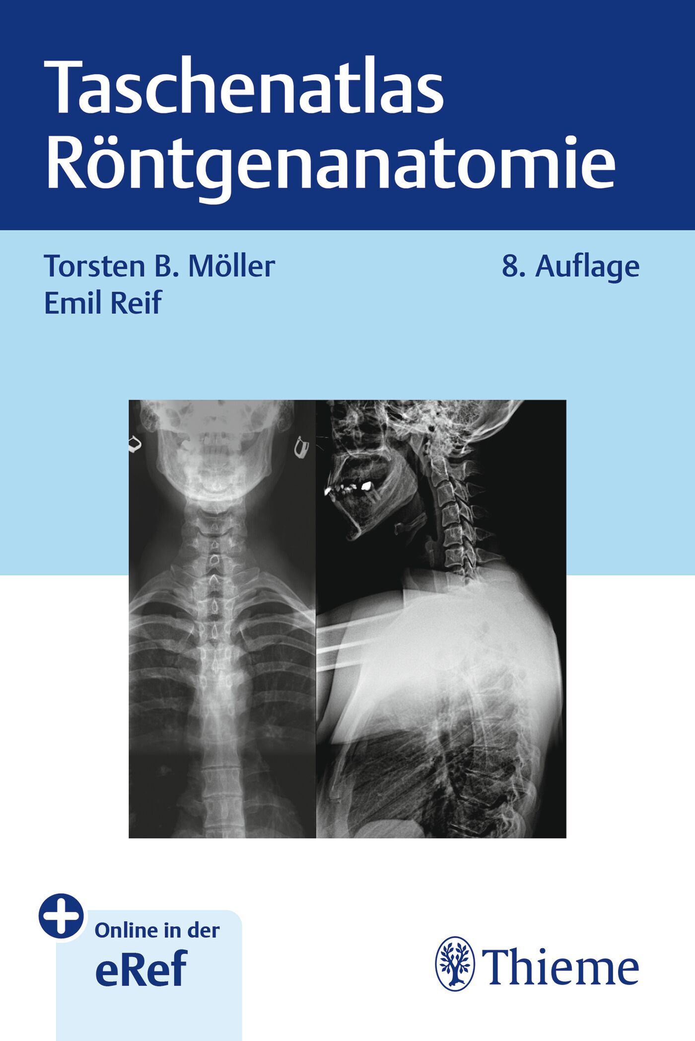 Taschenatlas Röntgenanatomie, 9783132460072