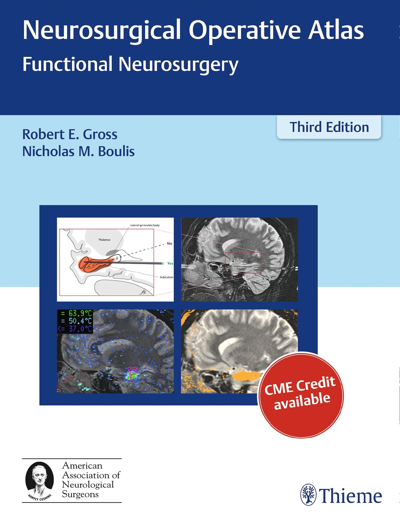 Neurosurgical Operative Atlas, 9781626231115
