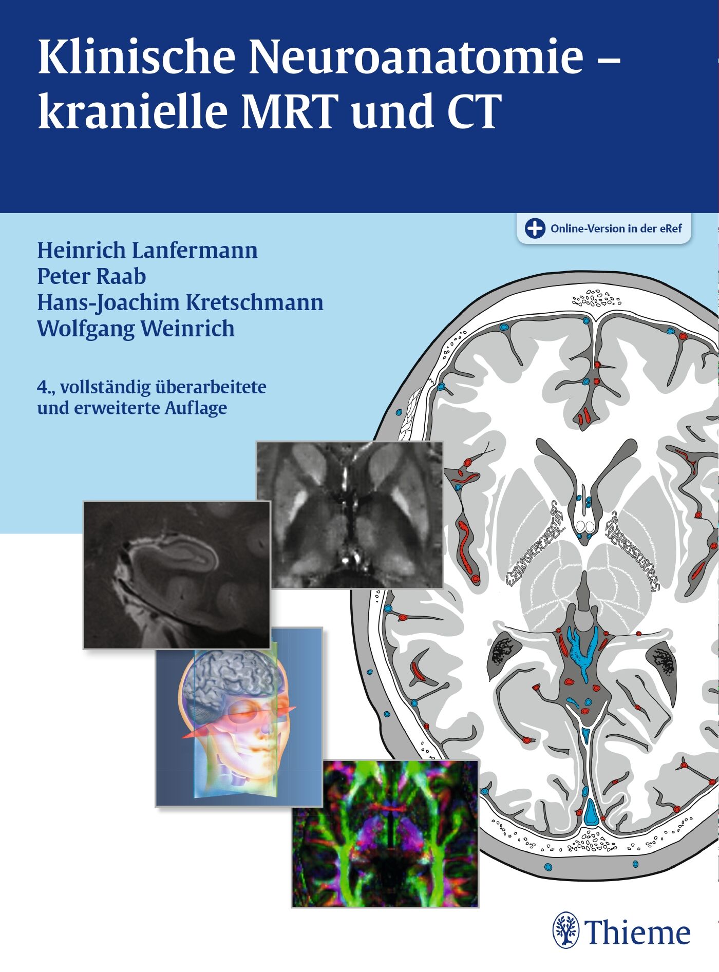 Klinische Neuroanatomie - kranielle MRT und CT, 9783132401433