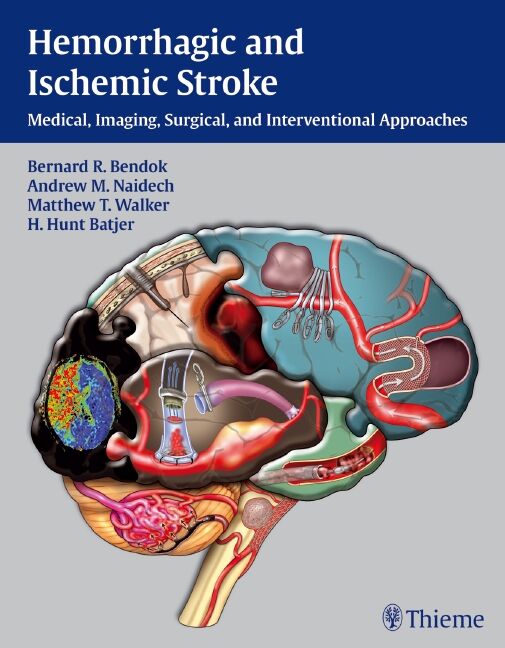 Hemorrhagic and Ischemic Stroke, 9781604062342