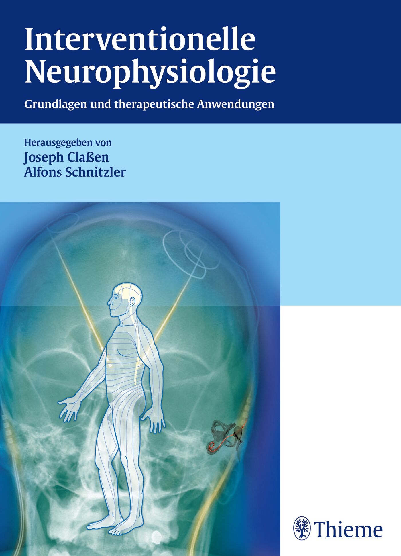 Interventionelle Neurophysiologie, 9783131698711