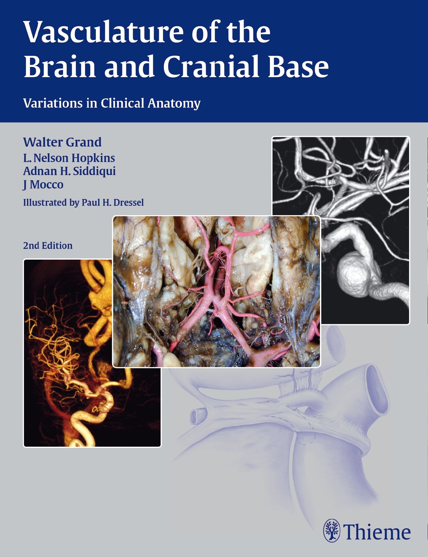 Vasculature of the Brain and Cranial Base, 9781604068856