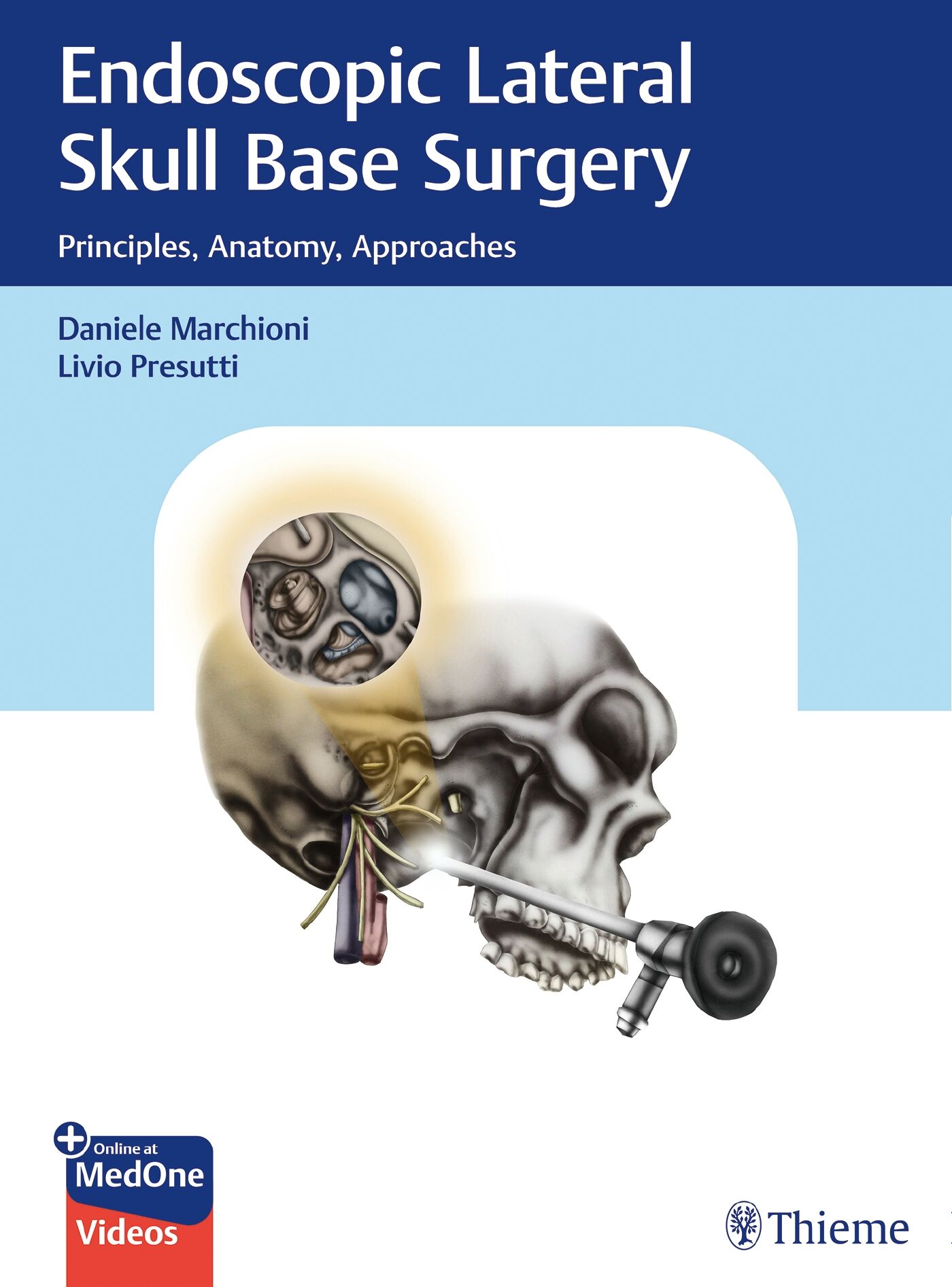Endoscopic Lateral Skull Base Surgery, 9783132414358