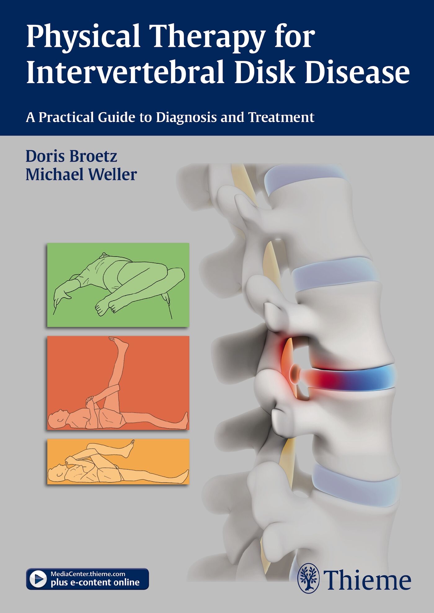 Guide, Physical Therapy Guide to Herniated Disk