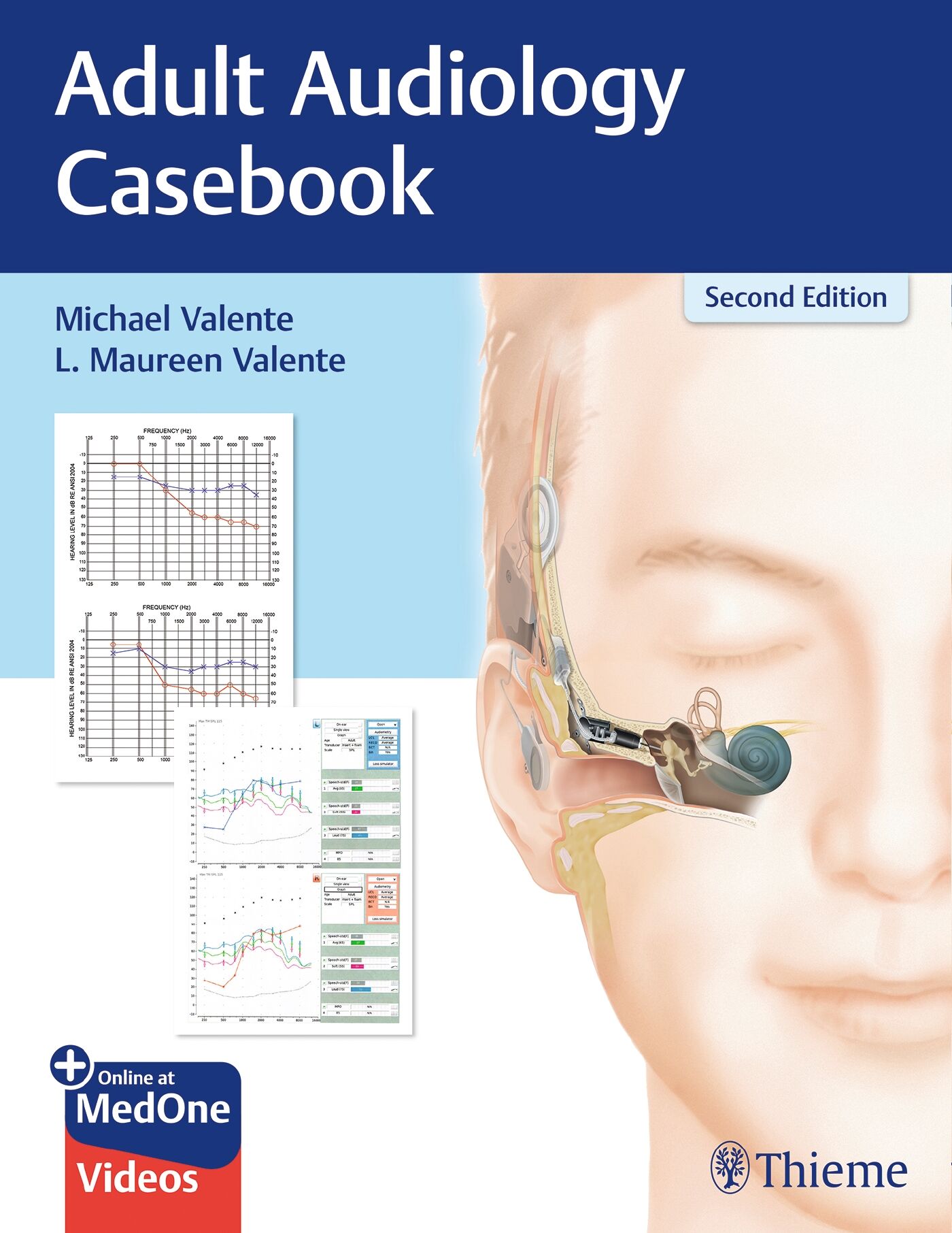 Adult Audiology Casebook, 9781626237292