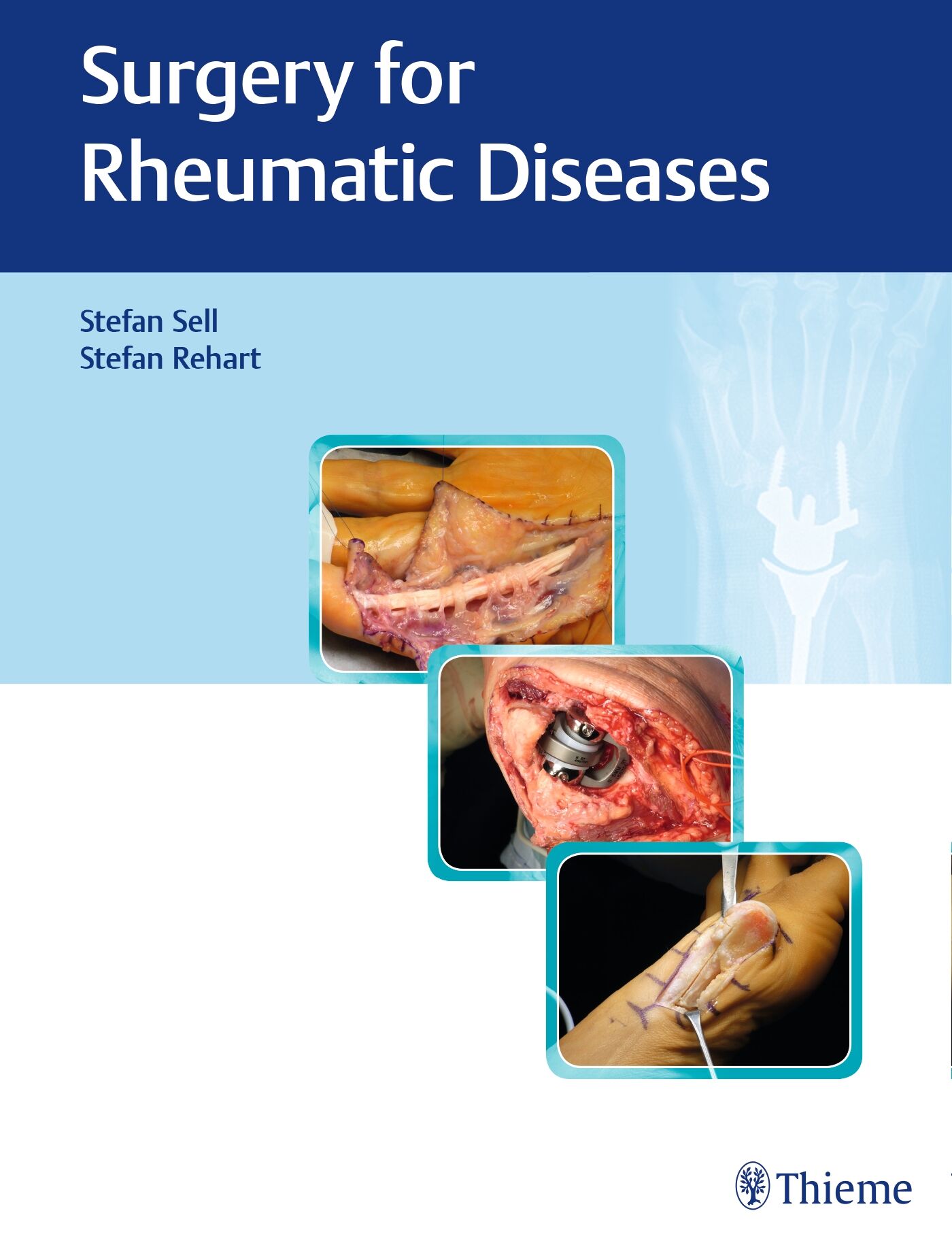 Surgery for Rheumatic Diseases, 9783132400078