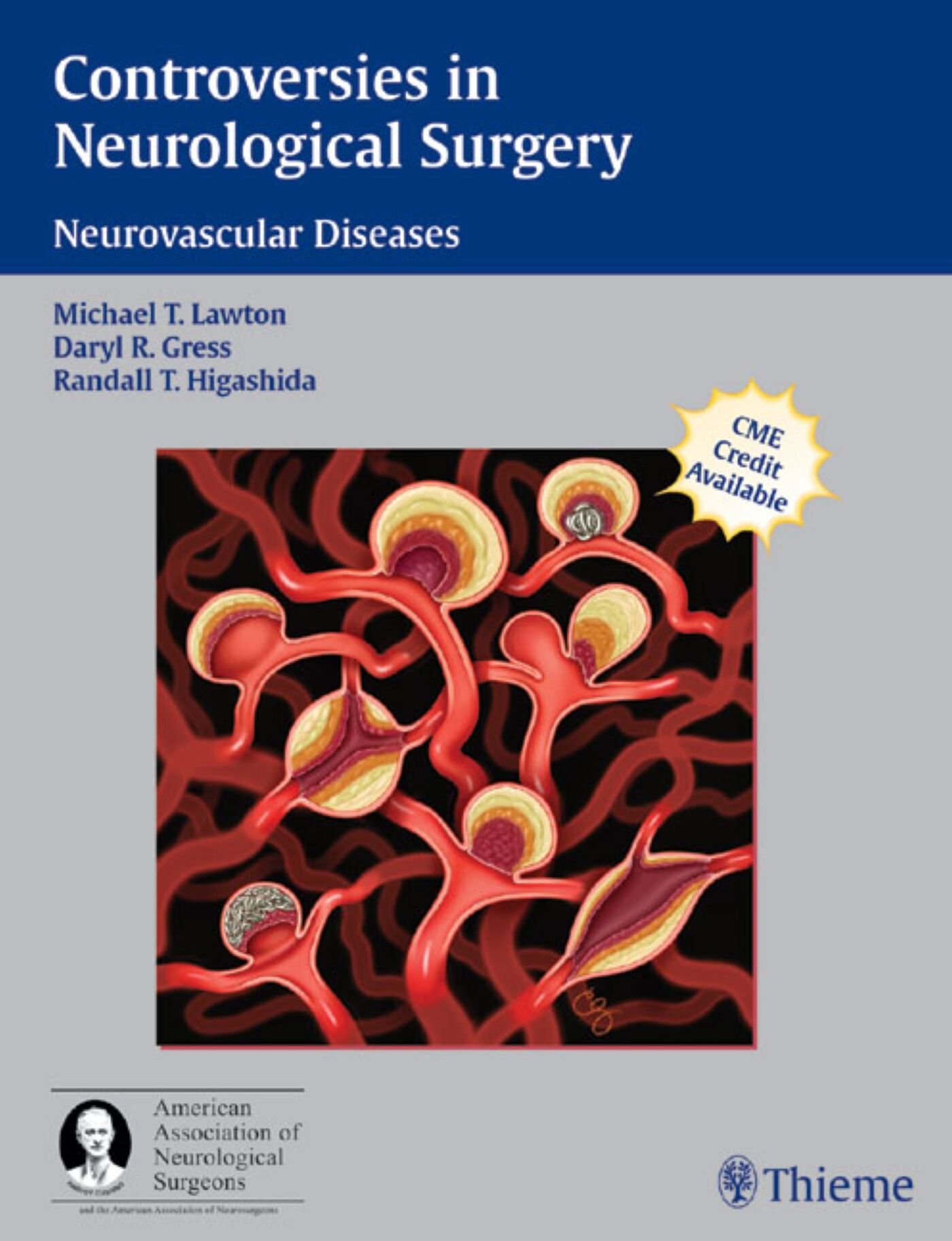 Controversies in Neurological Surgery, 9781588903440
