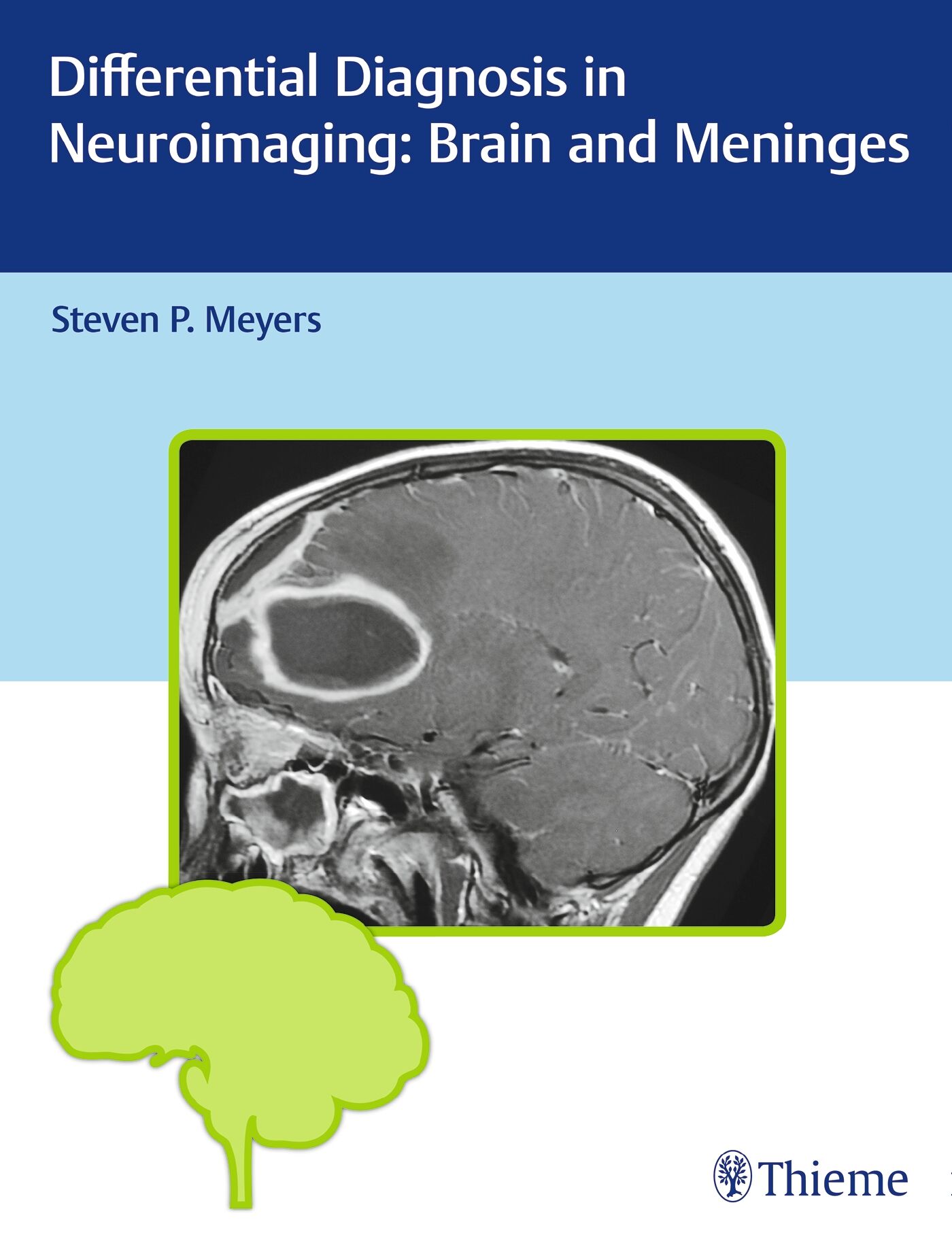 Differential Diagnosis in Neuroimaging: Brain and Meninges, 9781604067002
