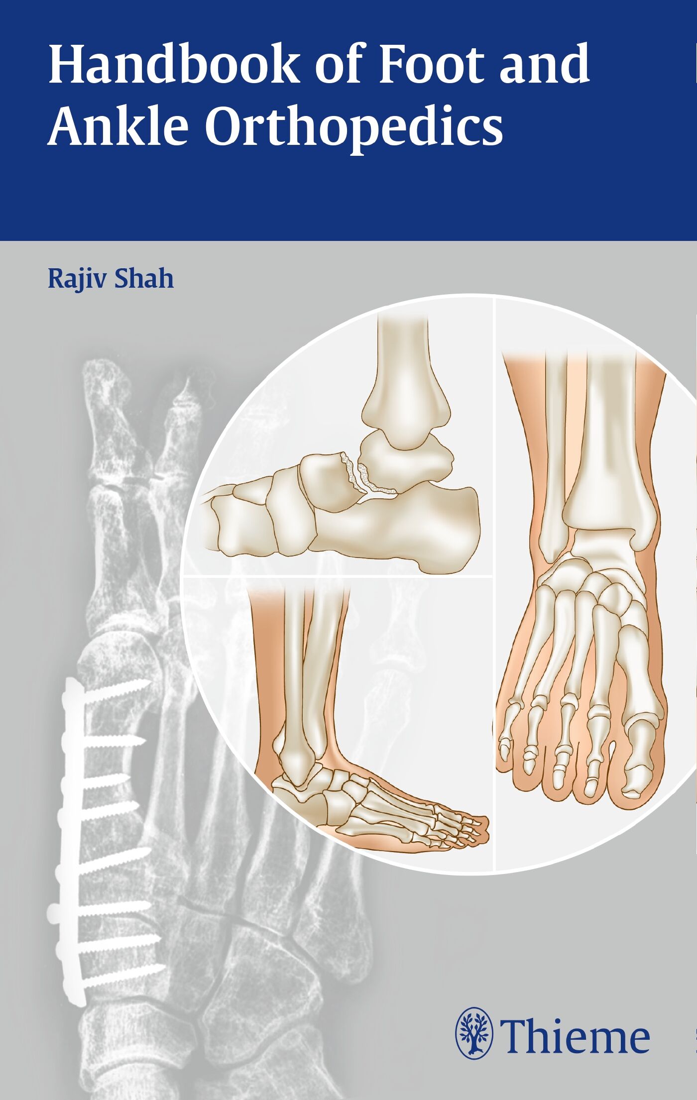 Handbook of Foot and Ankle Orthopedics, 9789385062230