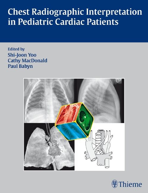 Chest Radiographic Interpretation in Pediatric Cardiac Patients, 9781604060362
