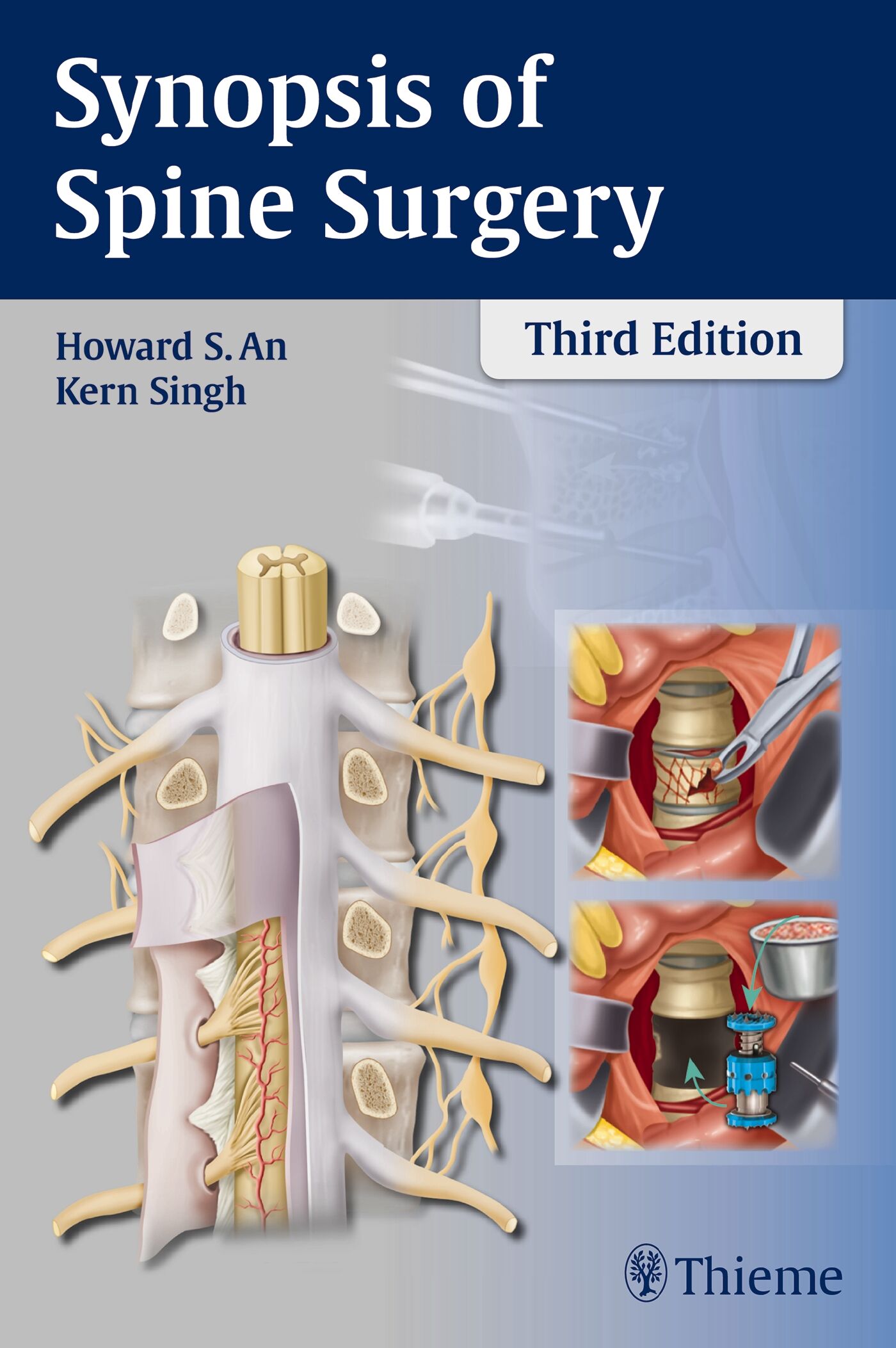 Synopsis of Spine Surgery, 9781626230309