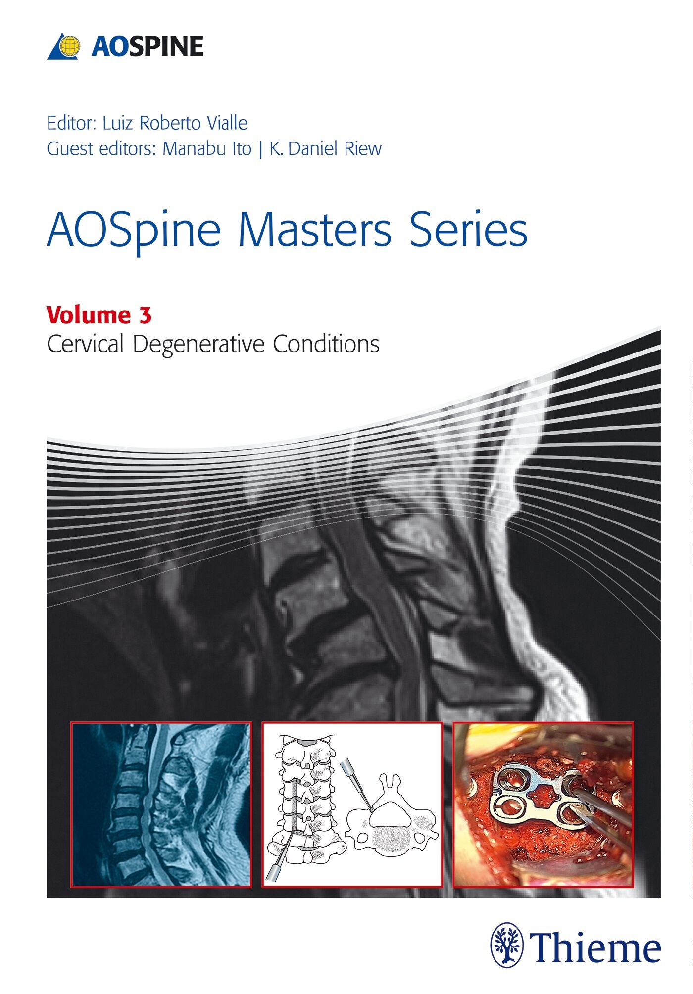 AOSpine Masters Series Volume 3: Cervical Degenerative Conditions, 9781626230507