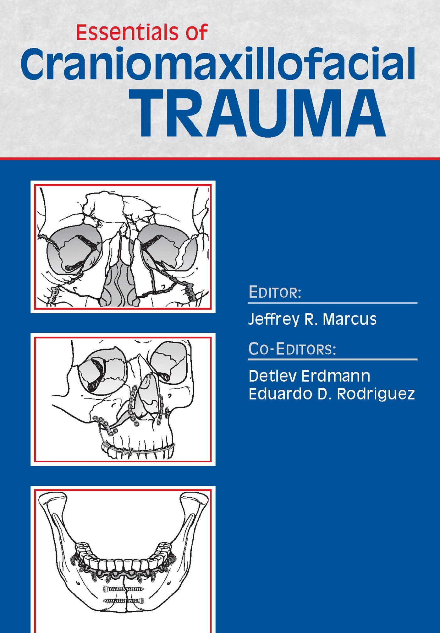 Essentials of Craniomaxillofacial Trauma, 9781626235595