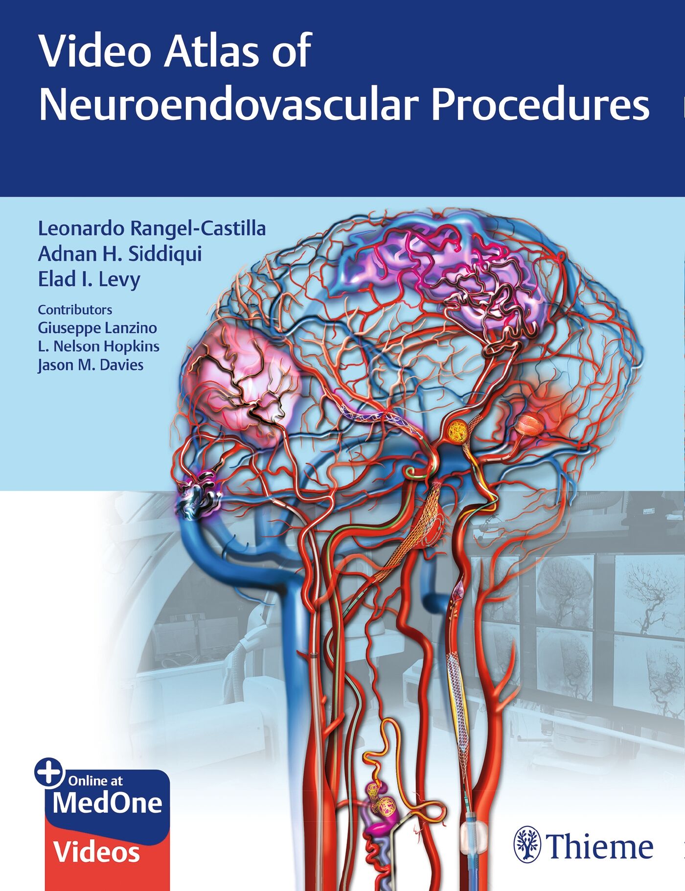 Video Atlas of Neuroendovascular Procedures, 9781684201181