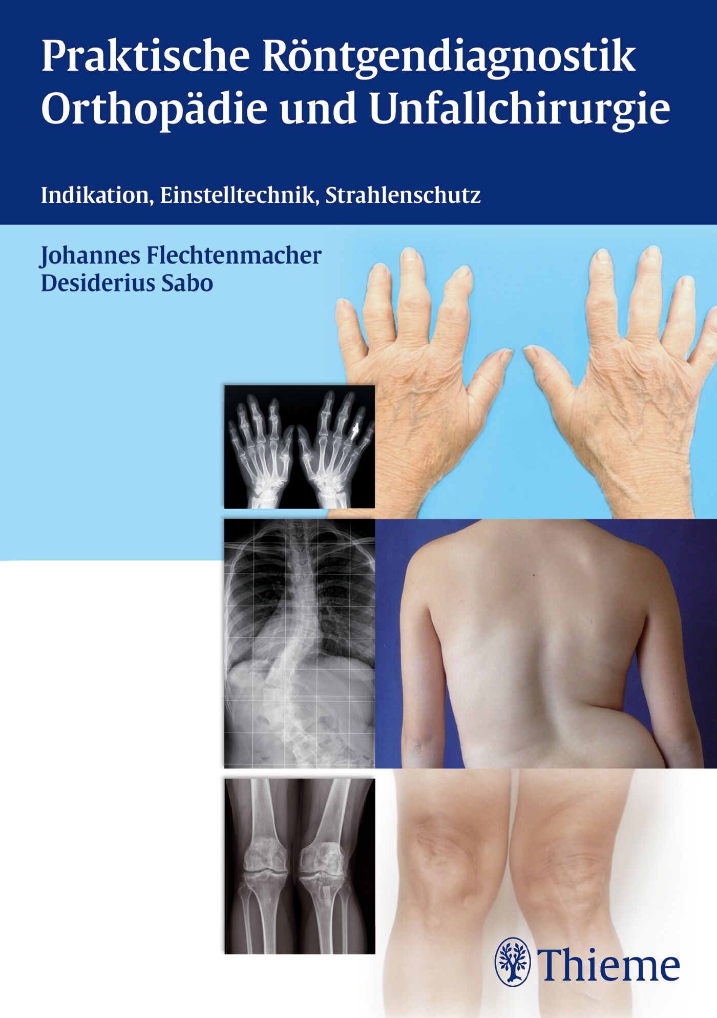 Praktische Röntgendiagnostik Orthopädie und Unfallchirurgie, 9783131731715