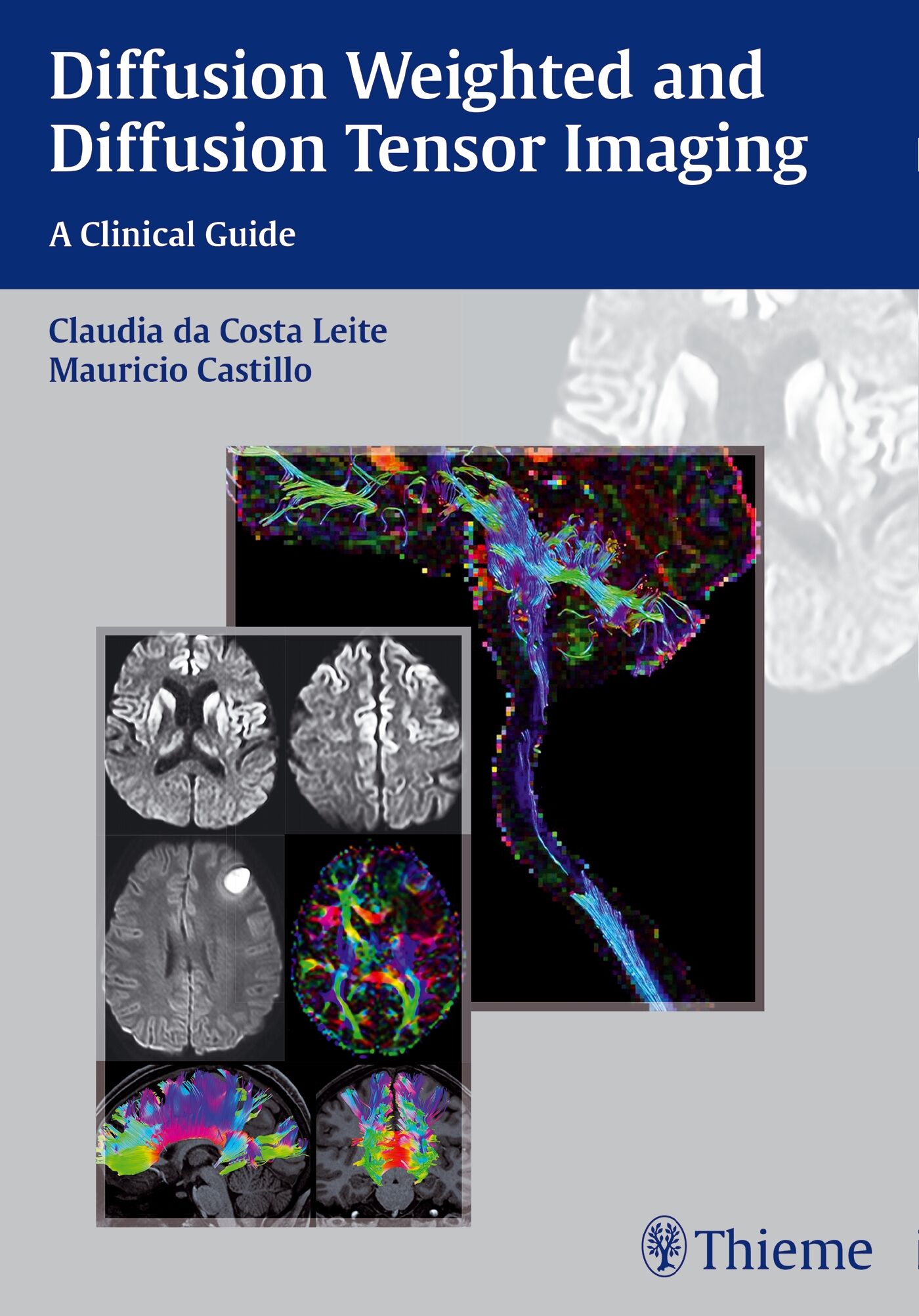 Diffusion Weighted and Diffusion Tensor Imaging, 9781626230217
