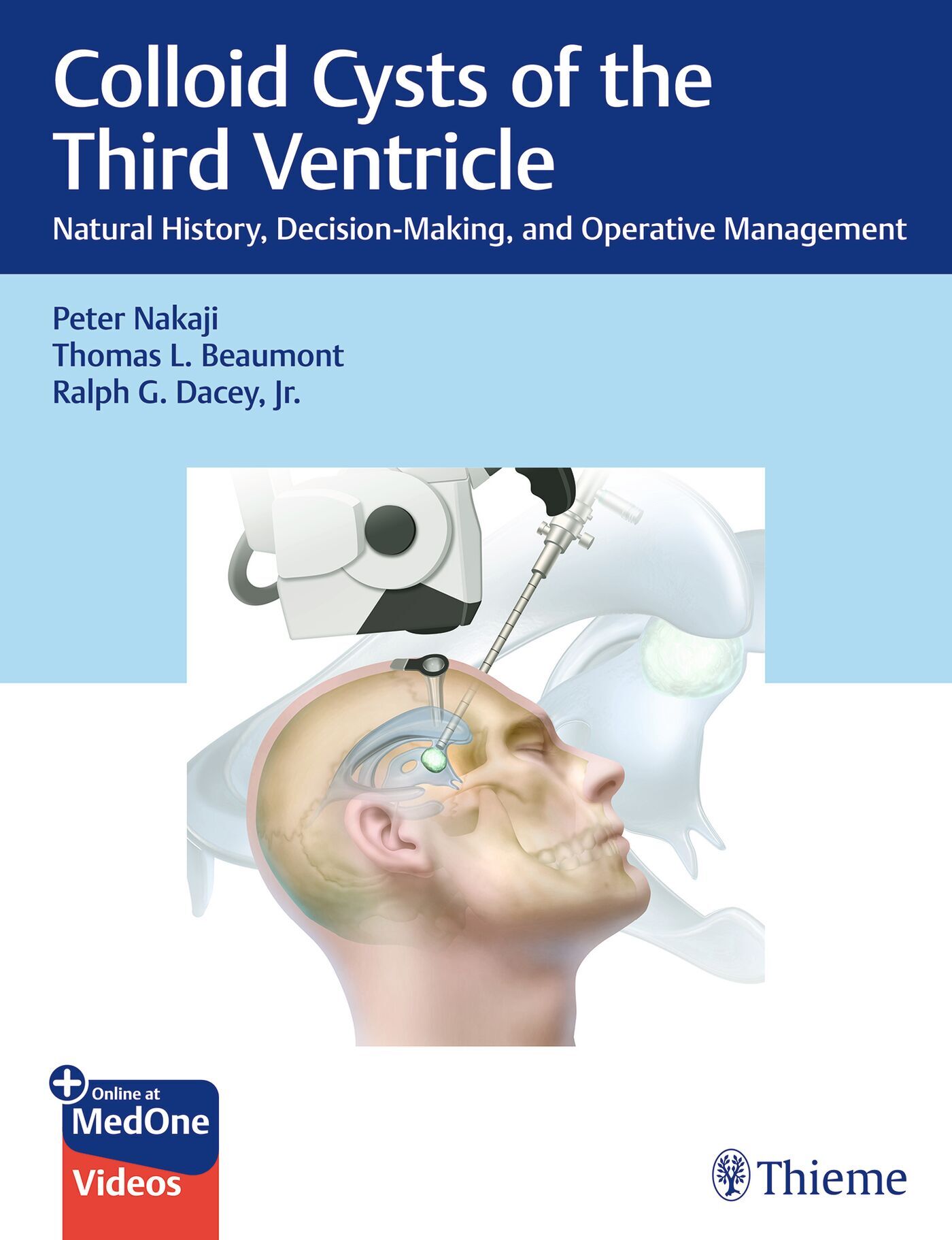 Colloid Cysts of the Third Ventricle, 9781684201570