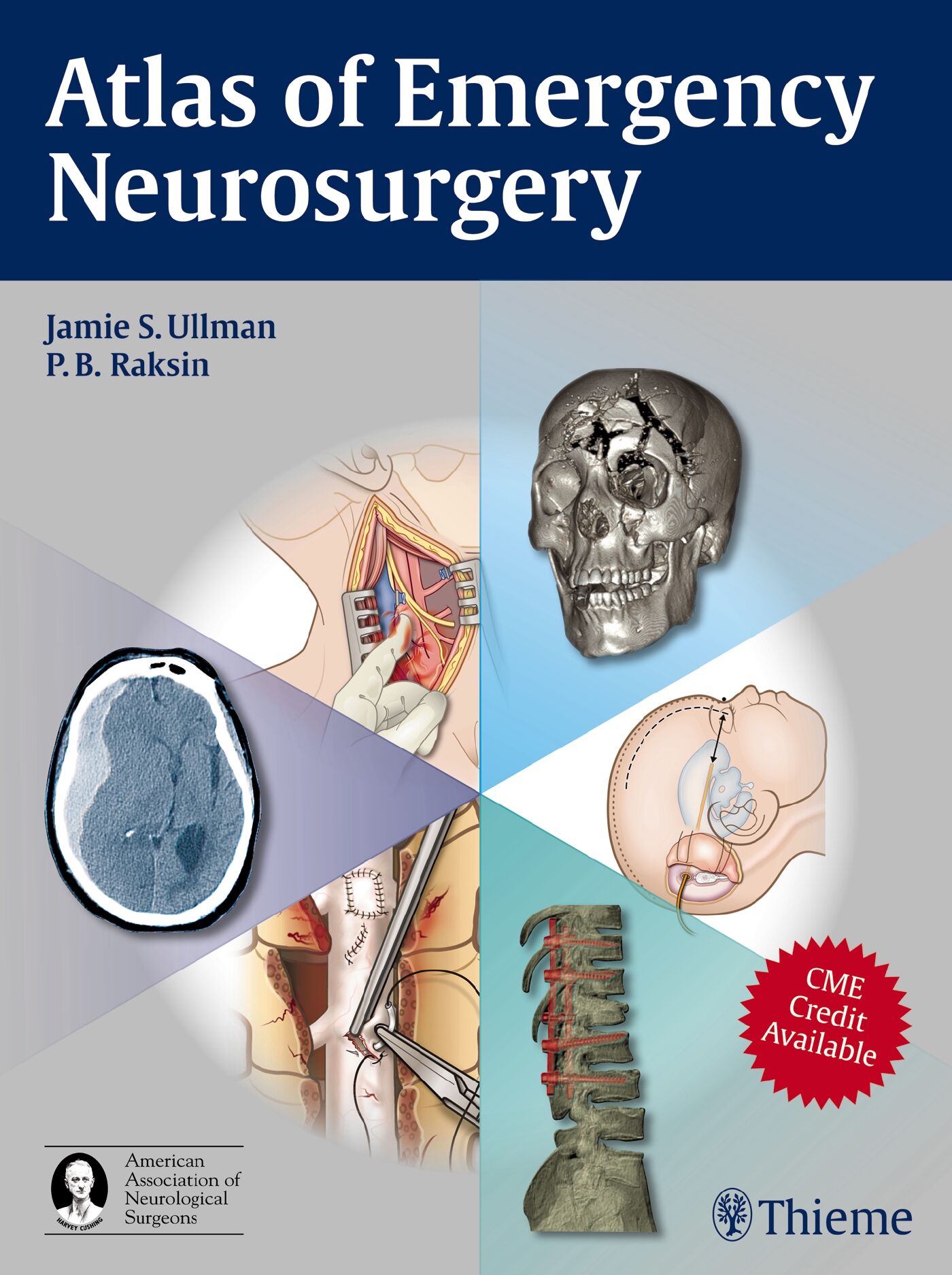 Atlas of Emergency Neurosurgery, 9781604063684