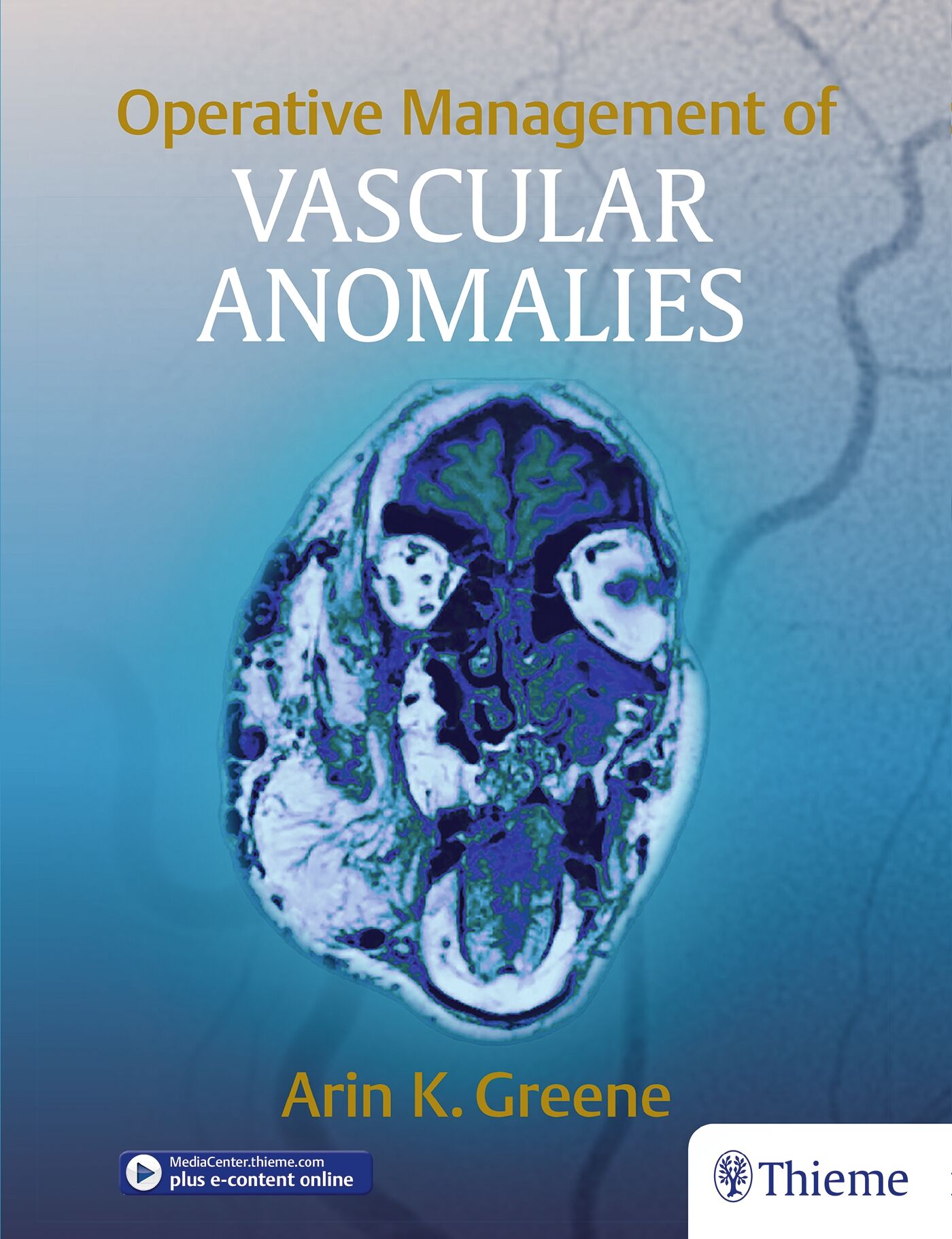 Operative Management of Vascular Anomalies, 9781626236905