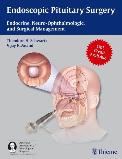 Endoscopic Pituitary Surgery, 9781604063479