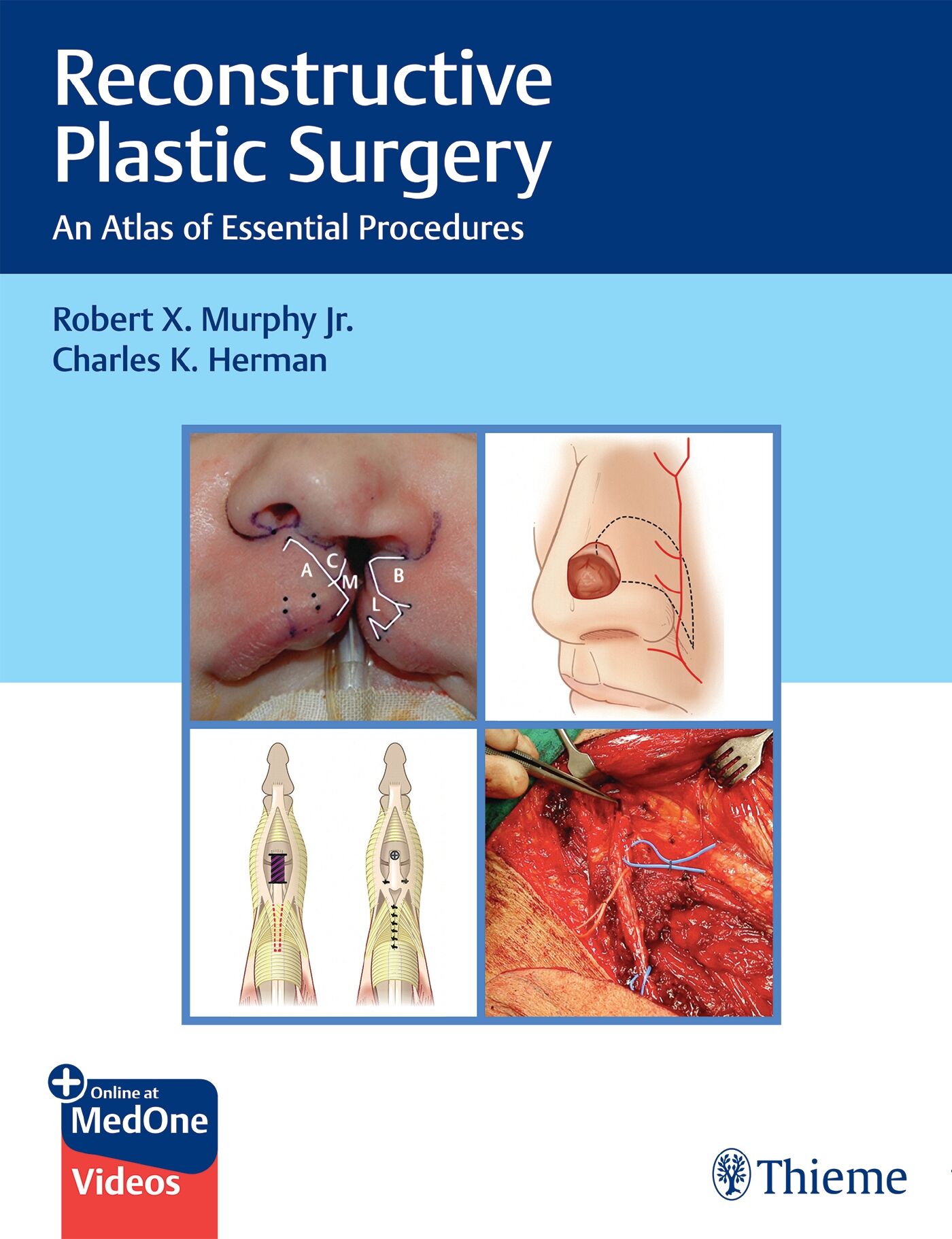 Reconstructive Plastic Surgery, 9781638534709