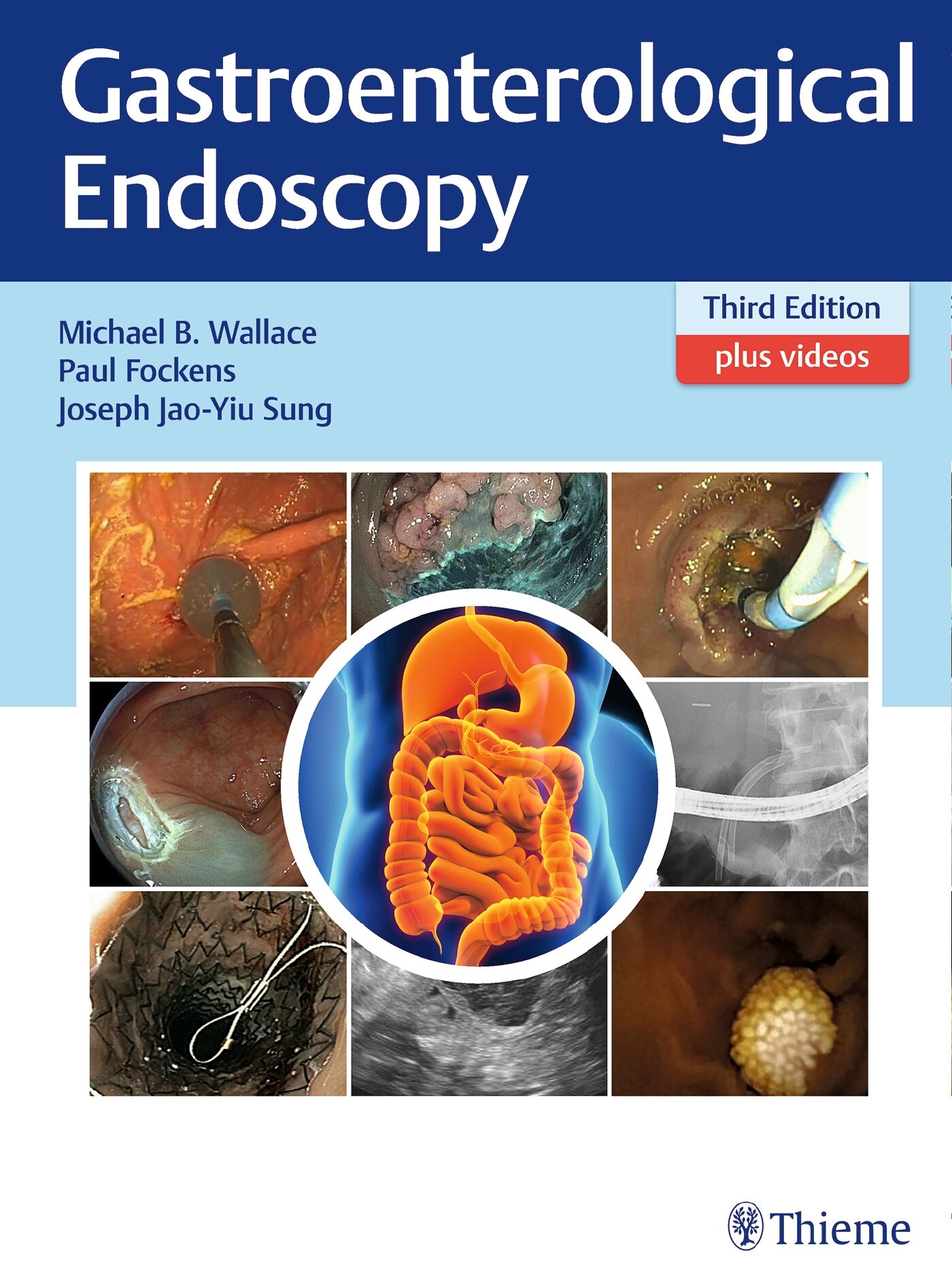 Gastroenterological Endoscopy, 9783131258533