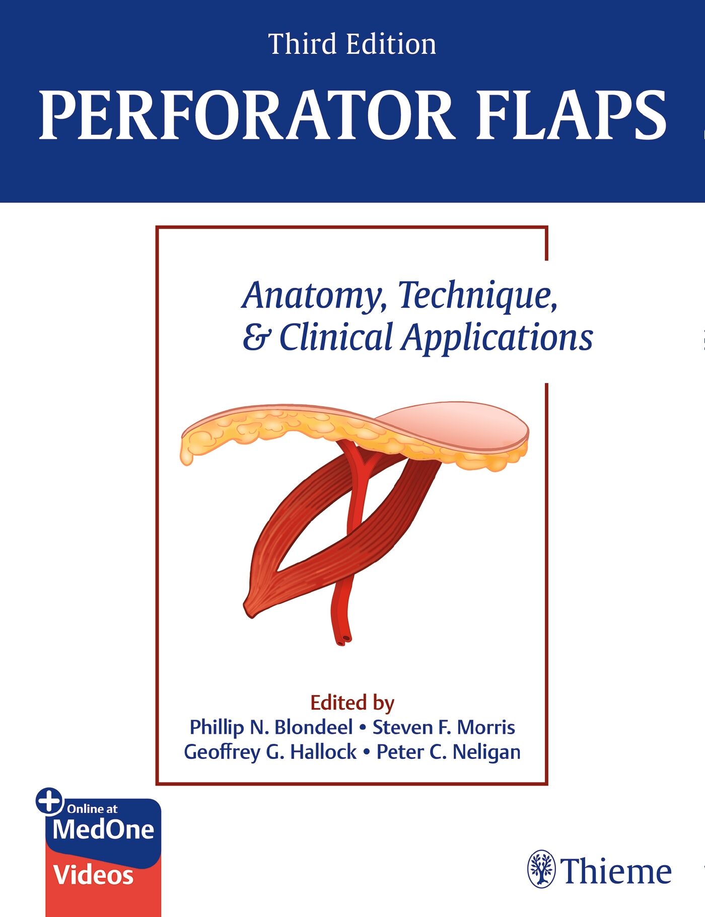 Perforator Flaps, 9781684200733