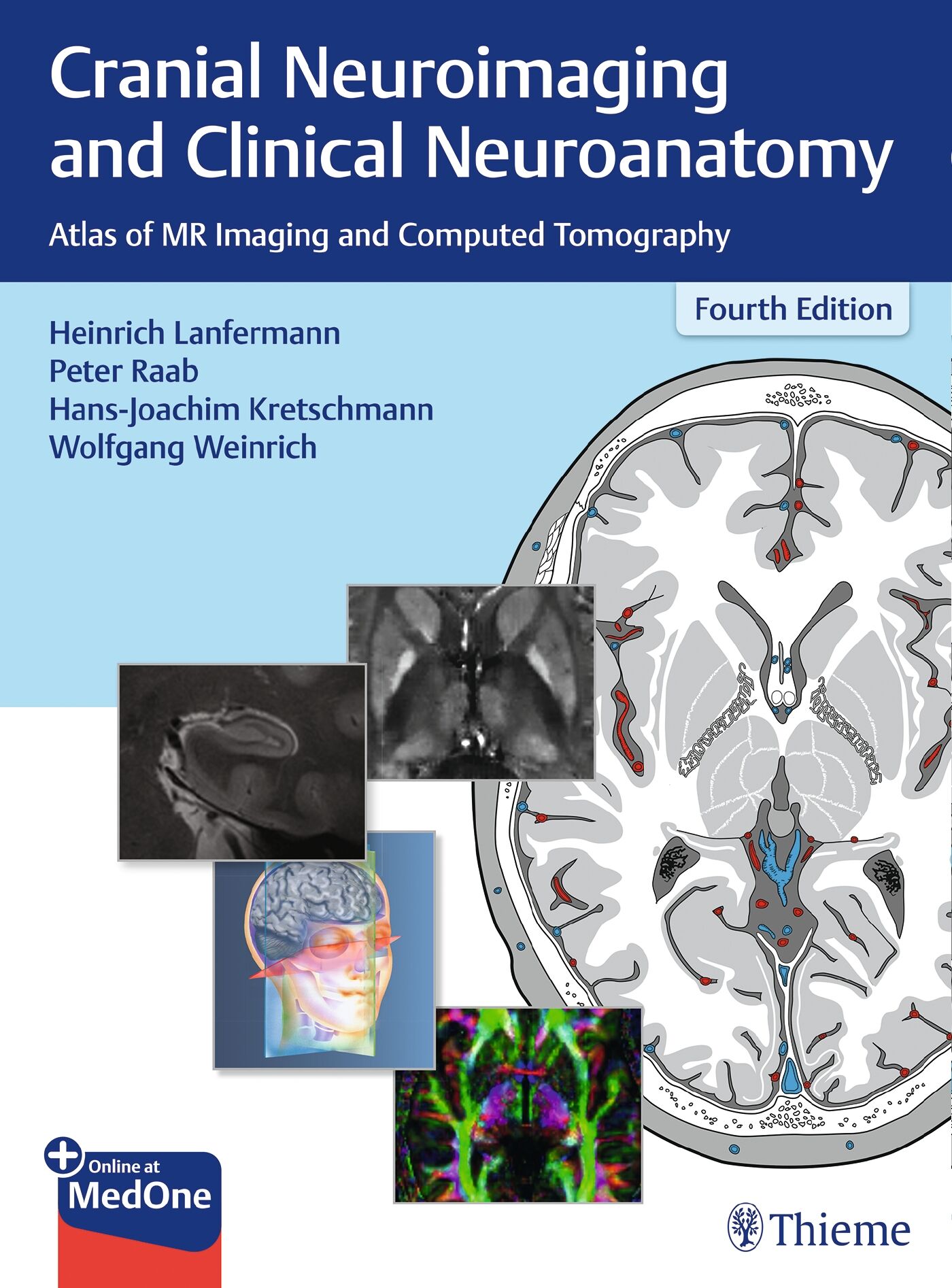 Cranial Neuroimaging and Clinical Neuroanatomy, 9783132578708