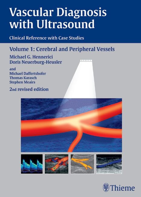 Vascular Diagnosis with Ultrasound, 9783131633620