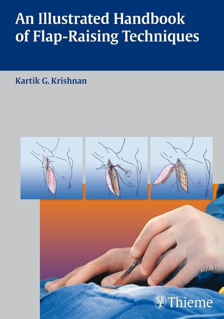 An Illustrated Handbook of Flap-Raising Techniques, 9783131477613