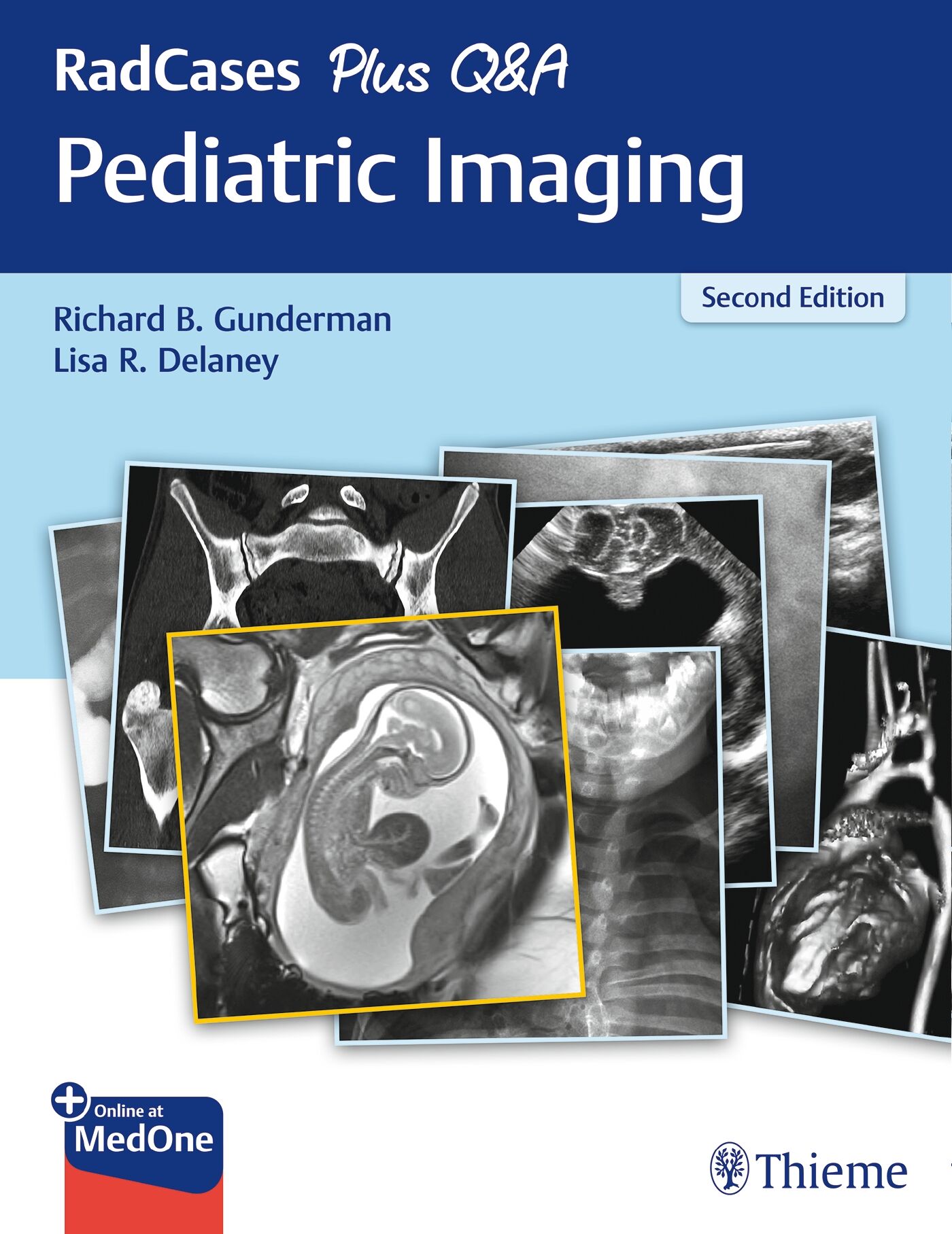 RadCases Plus Q&A Pediatric Imaging, 9781626235205