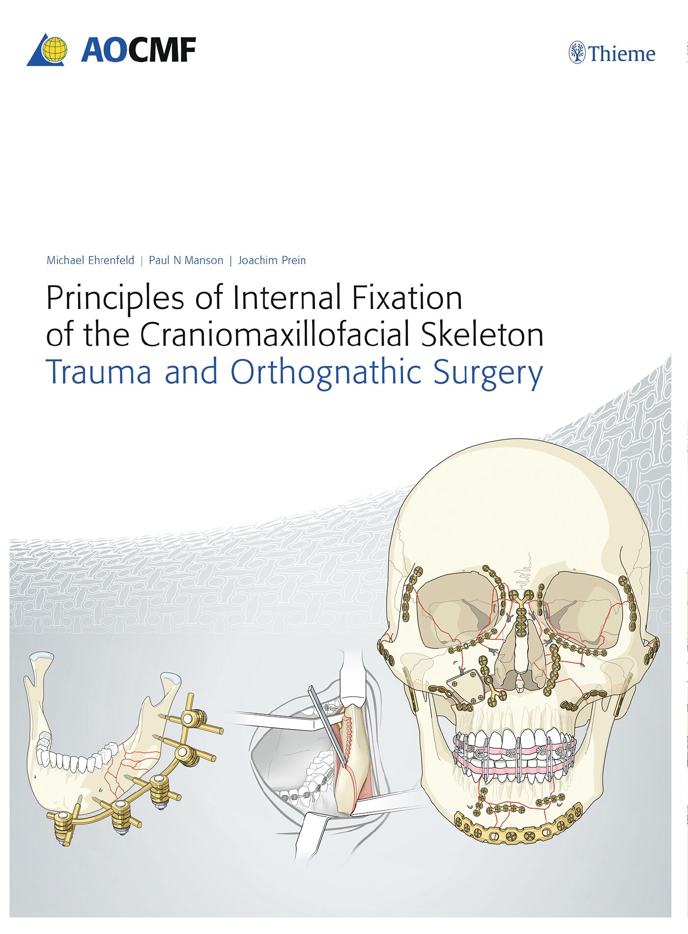 Principles of Internal Fixation of the Craniomaxillofacial Skeleton, 9783132579927