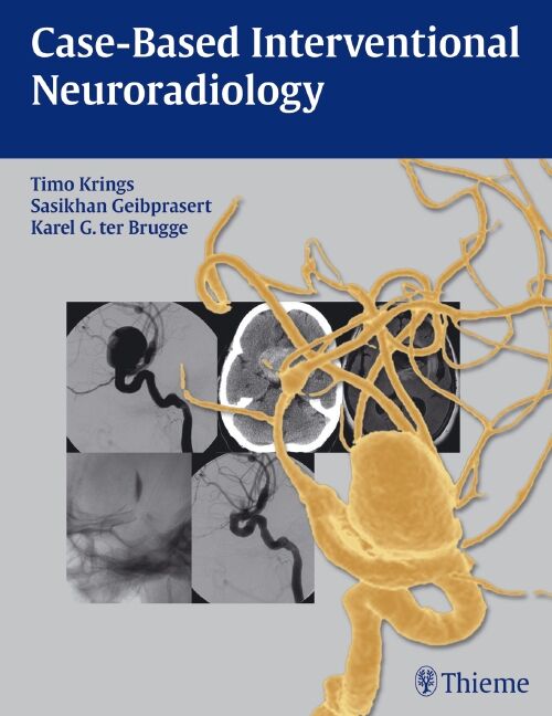 Case-Based Interventional Neuroradiology, 9781604063738