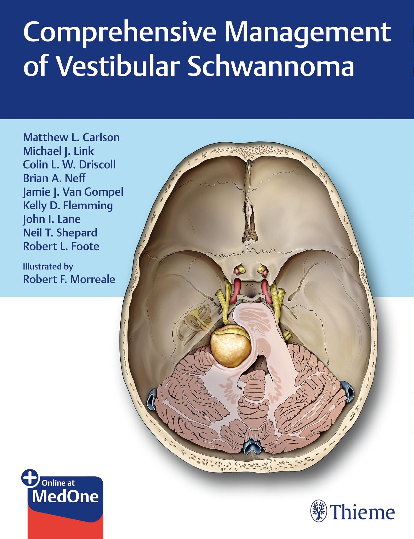 Comprehensive Management of Vestibular Schwannoma, 9781626233317