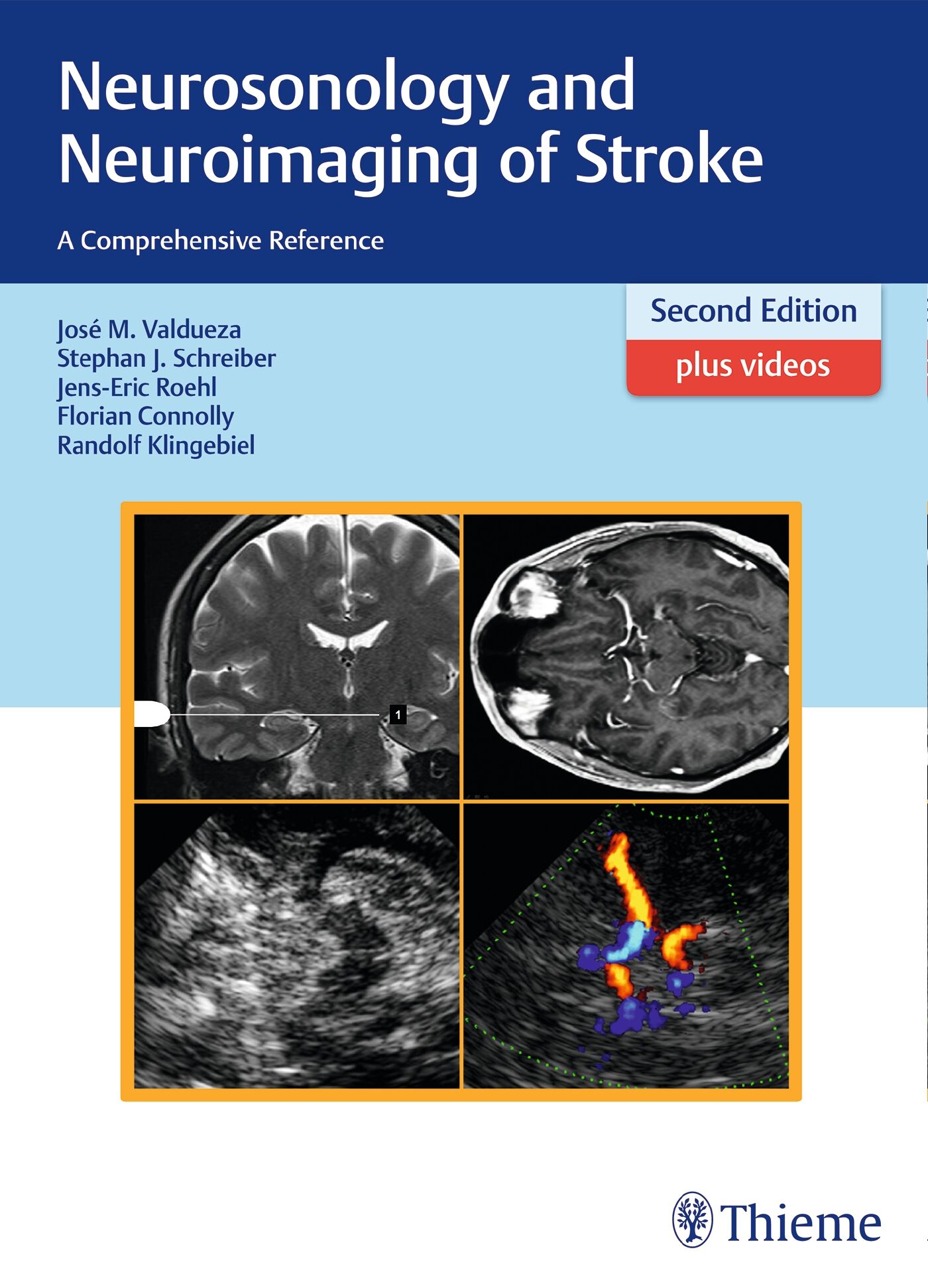 Neurosonology and Neuroimaging of Stroke, 9783131418722