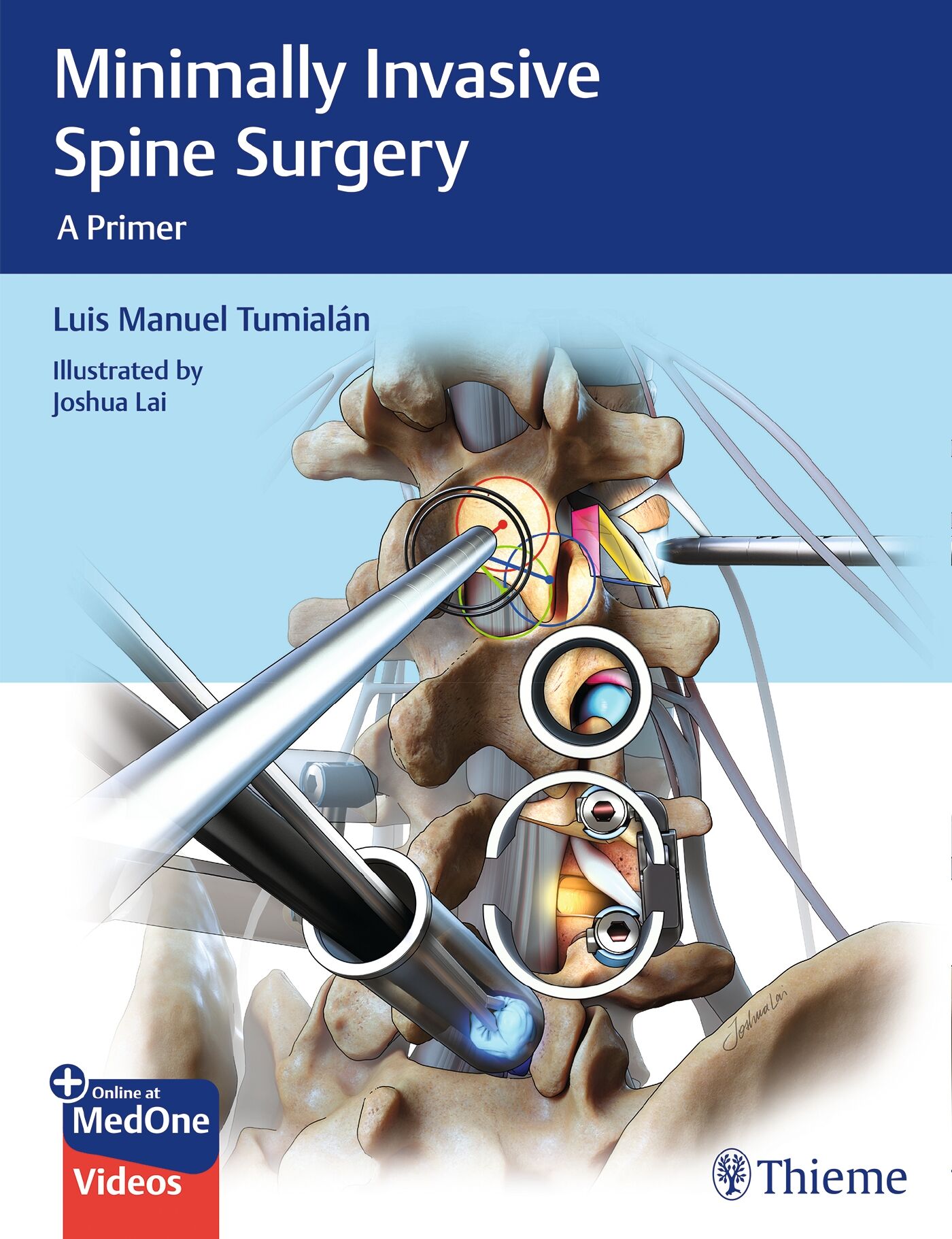 minimally-invasive-spine-surgery-9781626232181-thieme-webshop