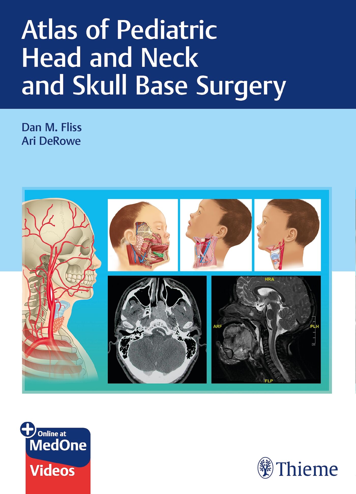 Atlas of Pediatric Head and Neck and Skull Base Surgery, 9783132414273