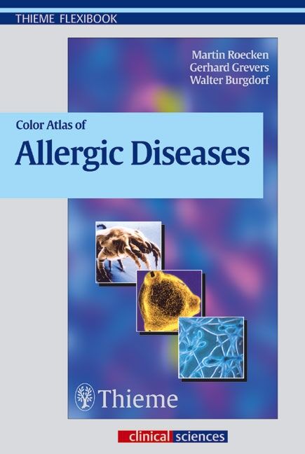 Color Atlas of Allergic Diseases, 9783131291912
