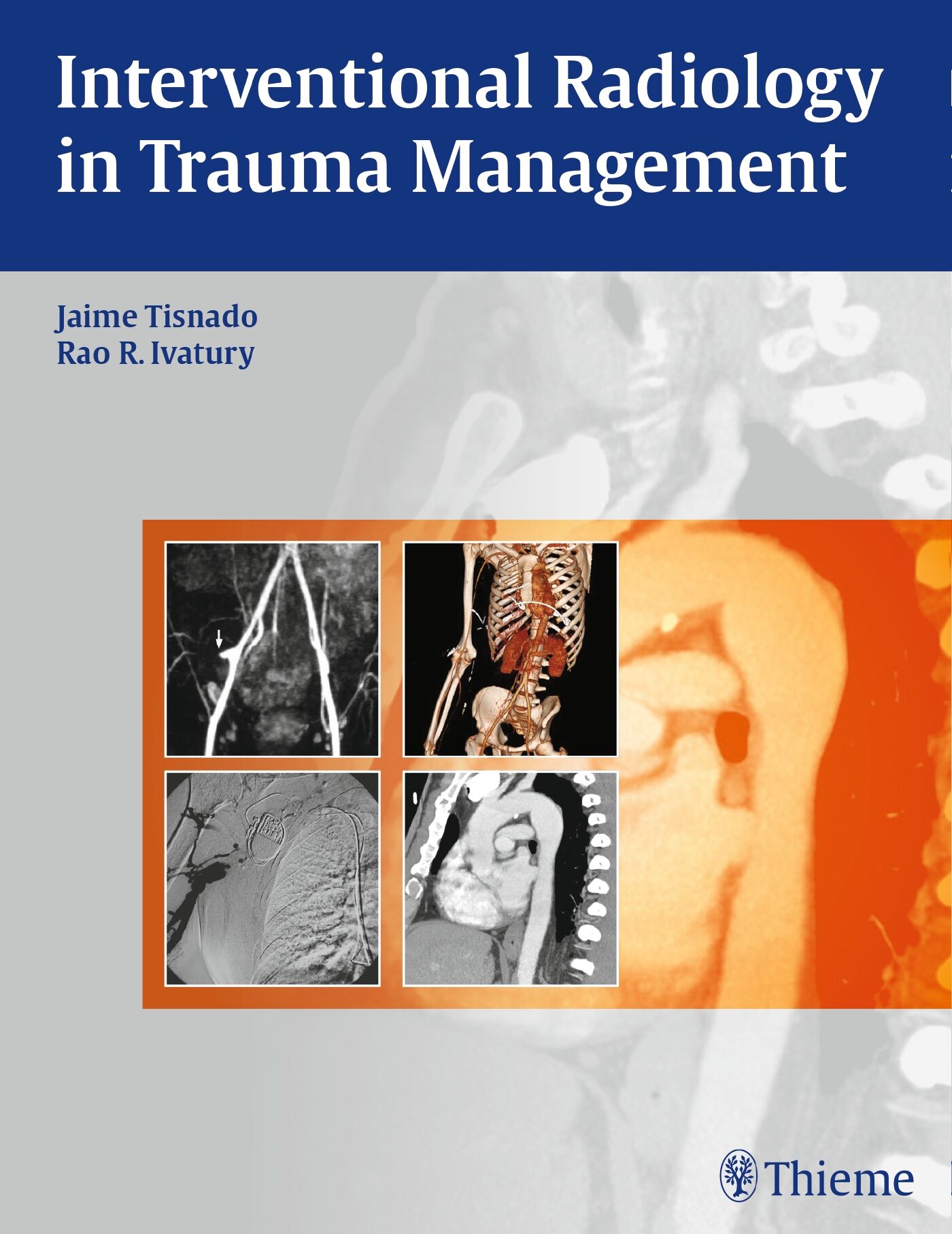 Interventional Radiology in Trauma, 9781604063110