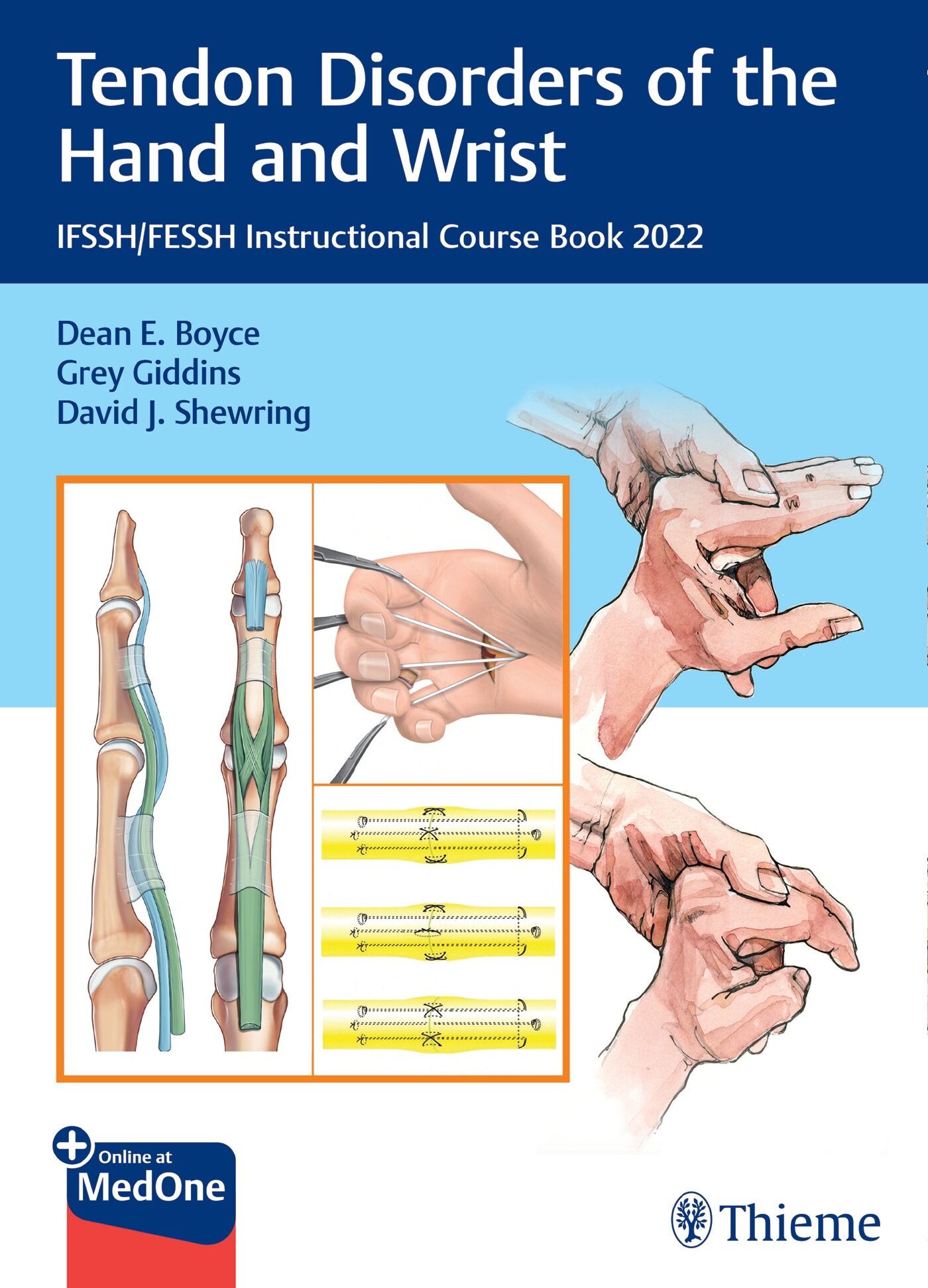 Tendon Disorders of the Hand and Wrist, 9783132442238