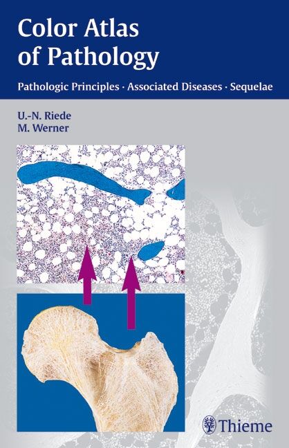 Color Atlas of Pathology, 9783131277817