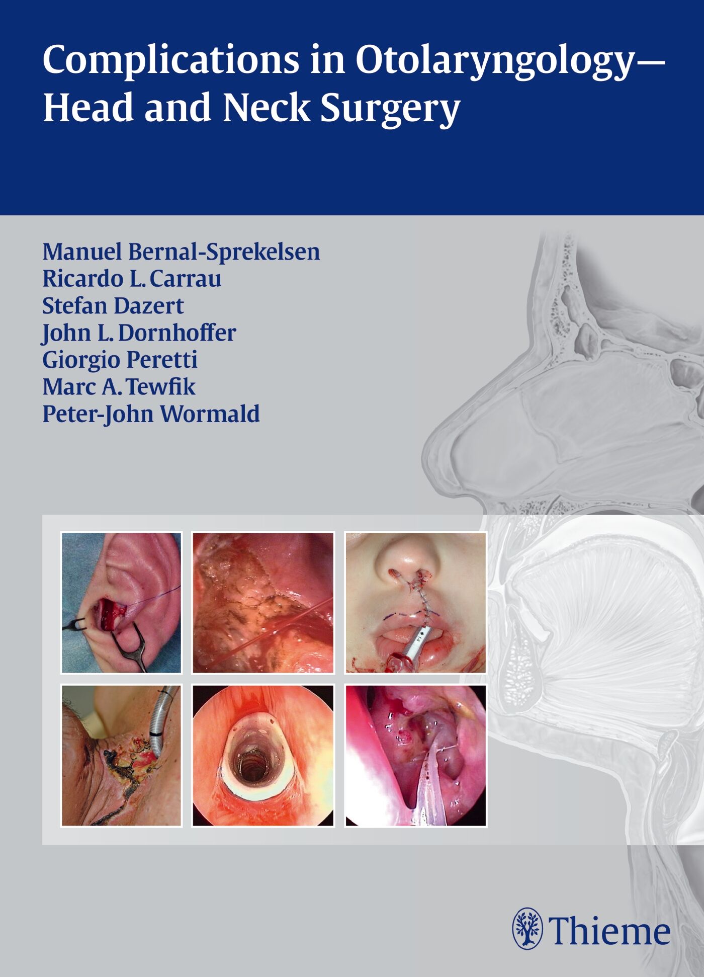 Complications in Otolaryngology - Head and Neck Surgery, 9783131605313