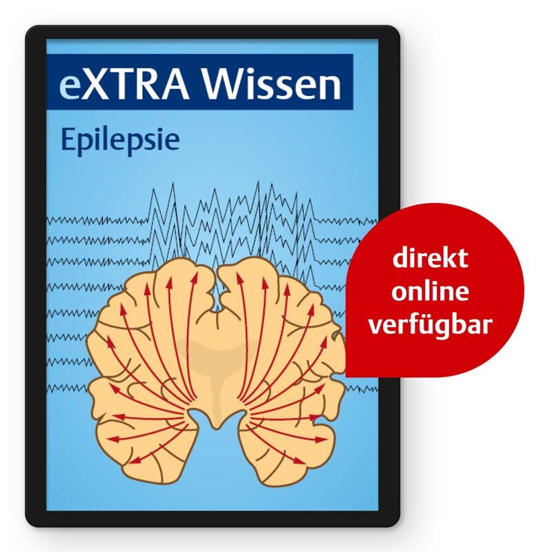 eXTRA Wissen - Epilepsie, 000000000322550101
